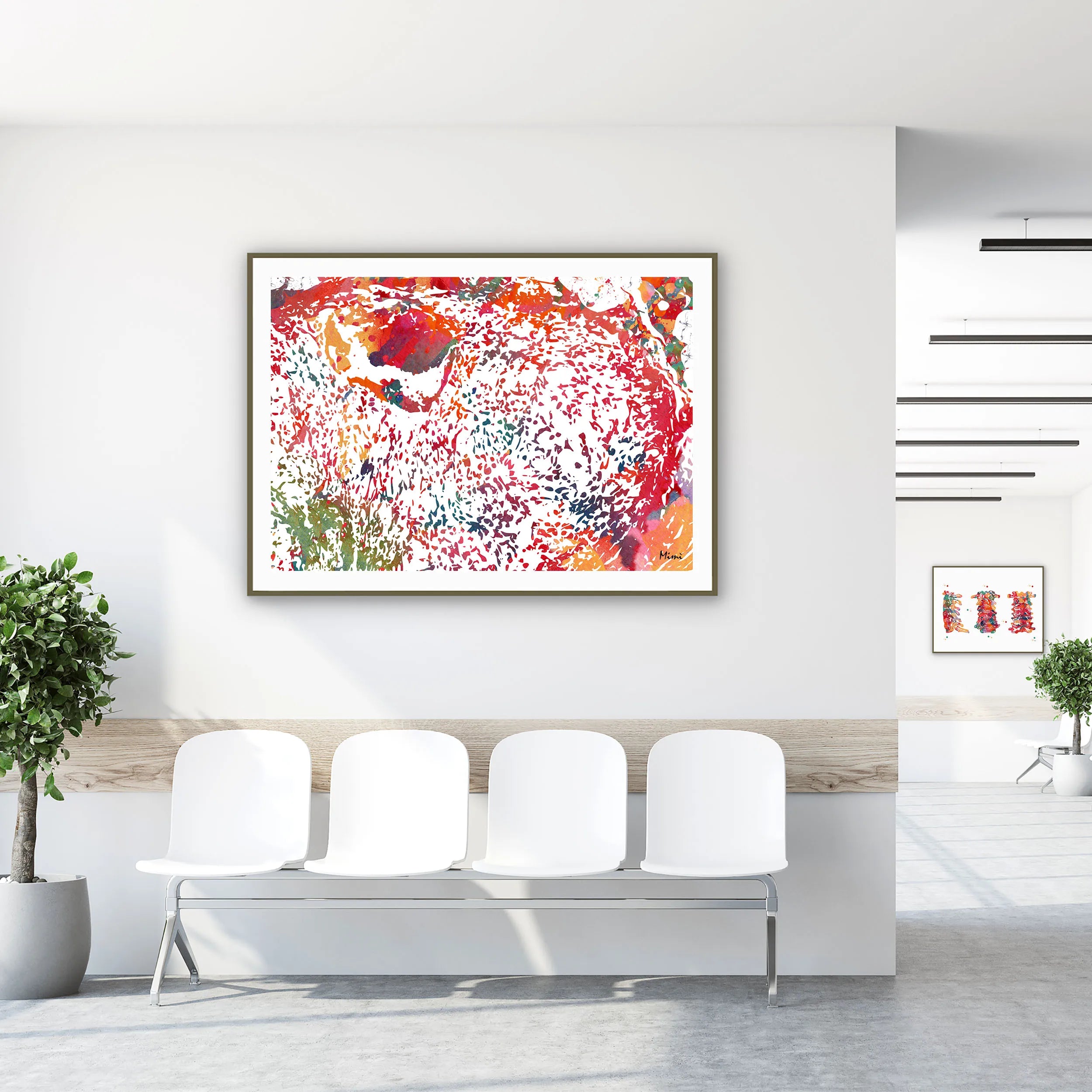 Framed chondrosarcoma watercolor print in a clinic waiting room