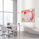 Framed chondrosarcoma watercolor print in an orthopedic clinic