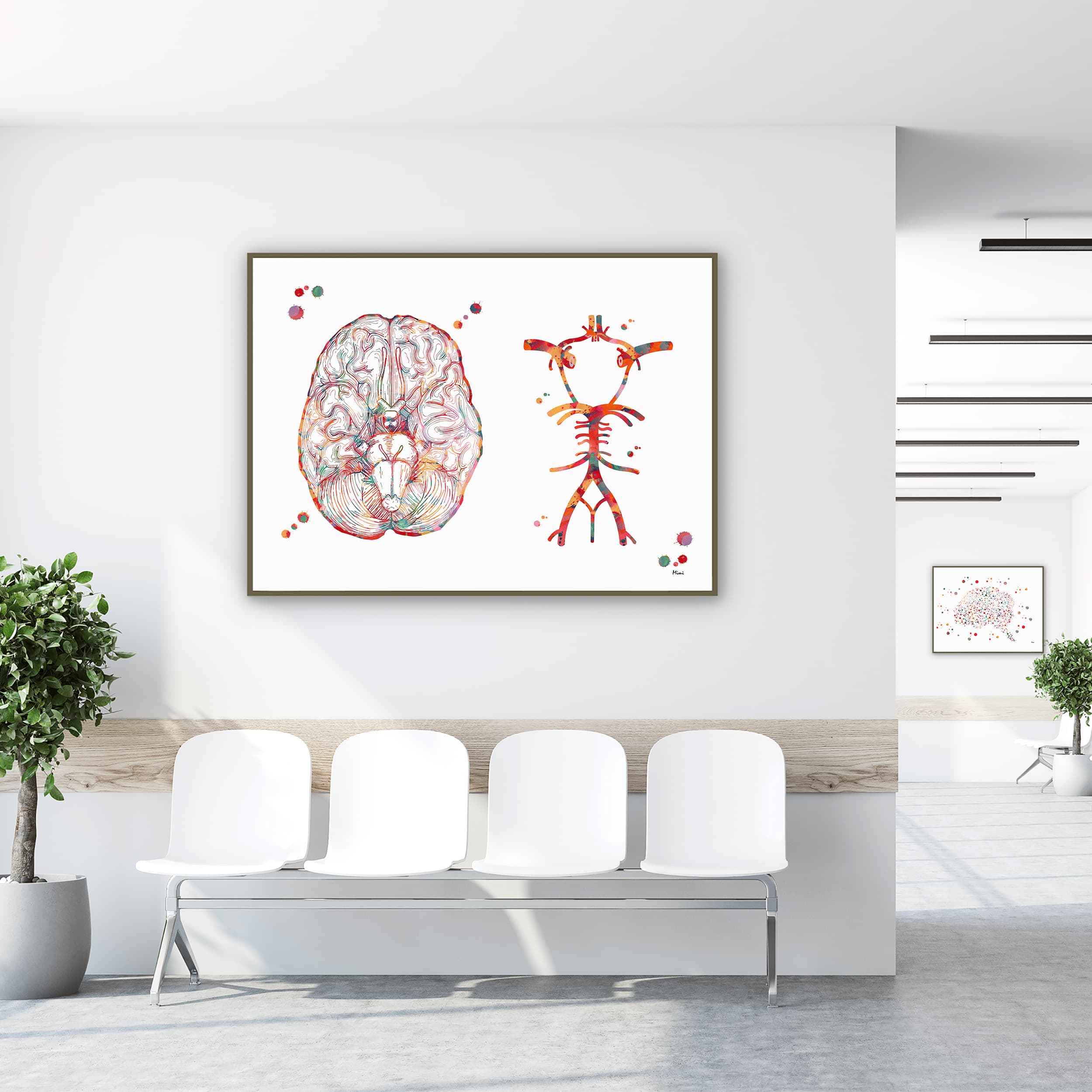 Framed circle of willis cerebral arteries watercolor print in a clinic waiting room