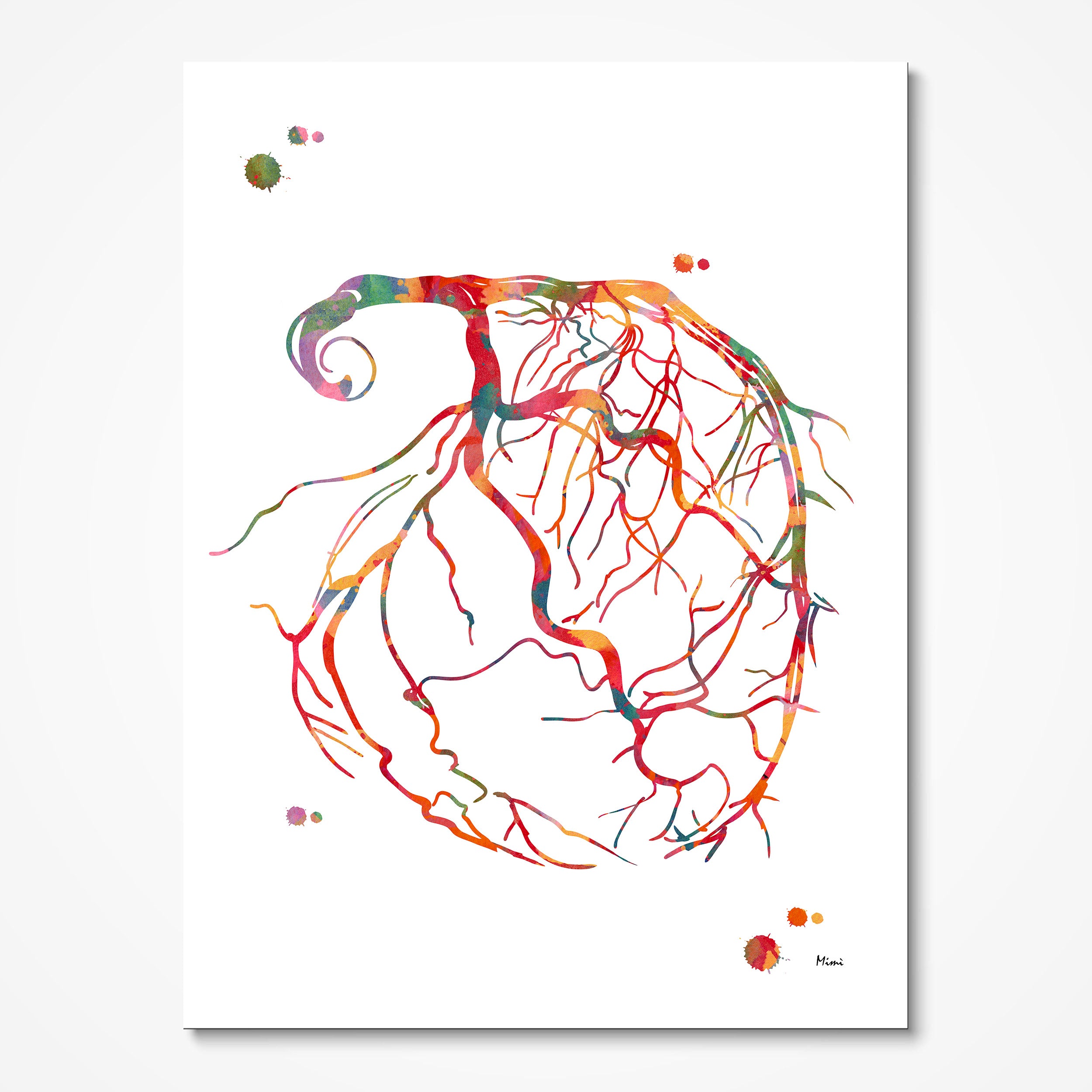 Coronary angiogram watercolor art print for cardiology clinic wall decor