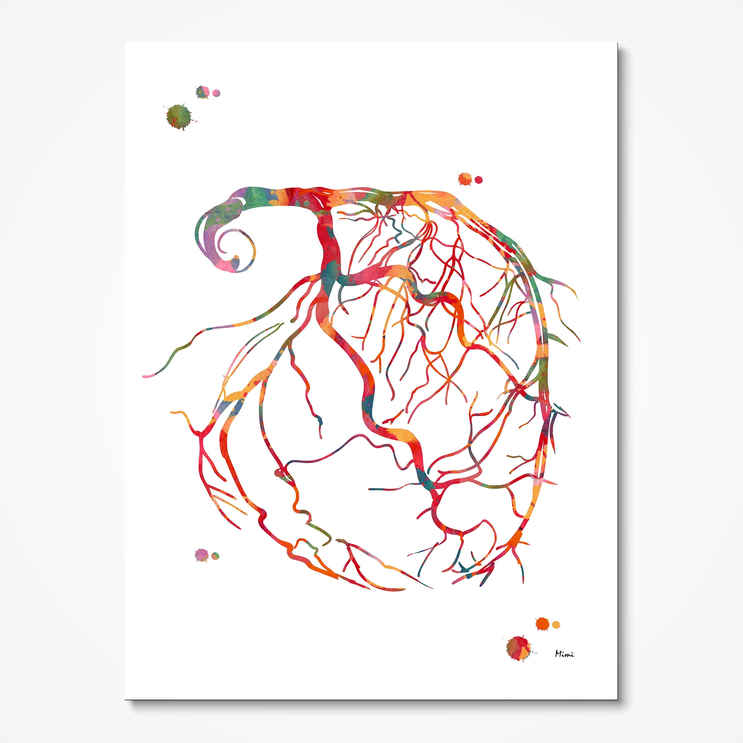 Coronary angiogram watercolor art print for cardiology clinic wall decor