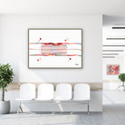 Framed coronary stent angioplasty watercolor print in a clinic waiting room