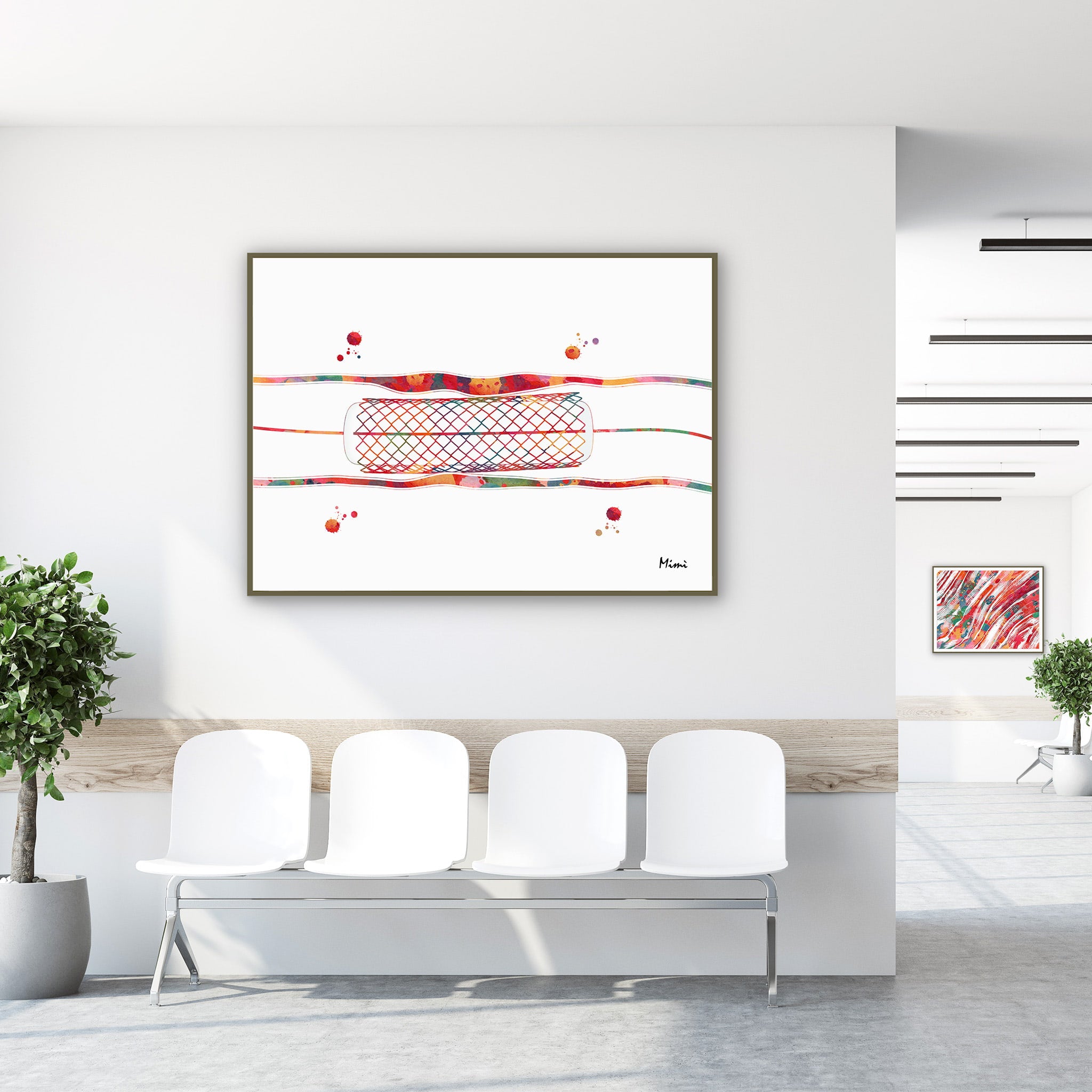 Framed coronary stent angioplasty watercolor print in a clinic waiting room