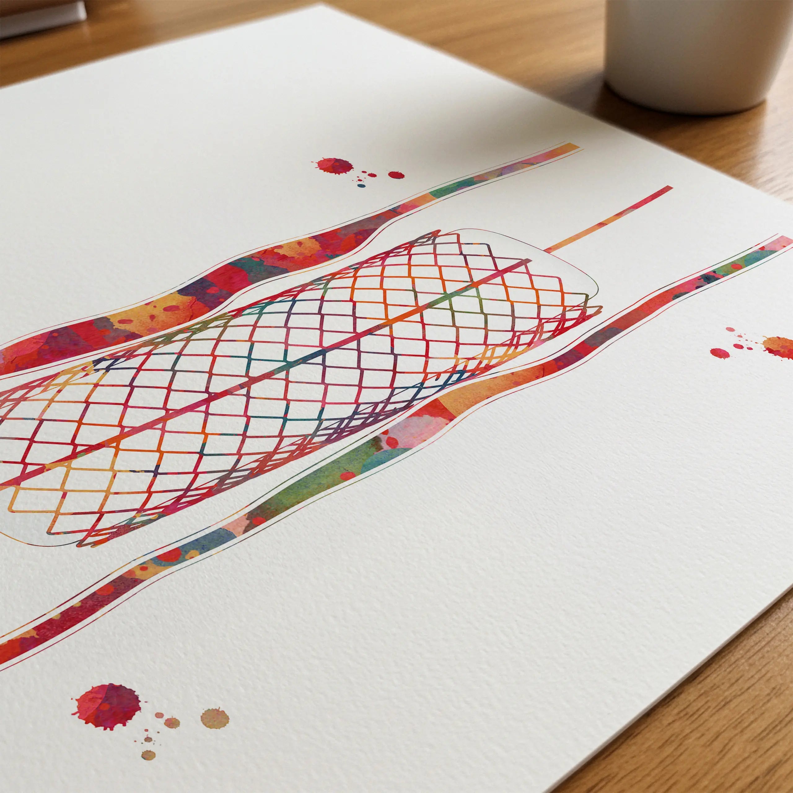 Close-up of coronary stent angioplasty watercolor print showing paper texture and grain