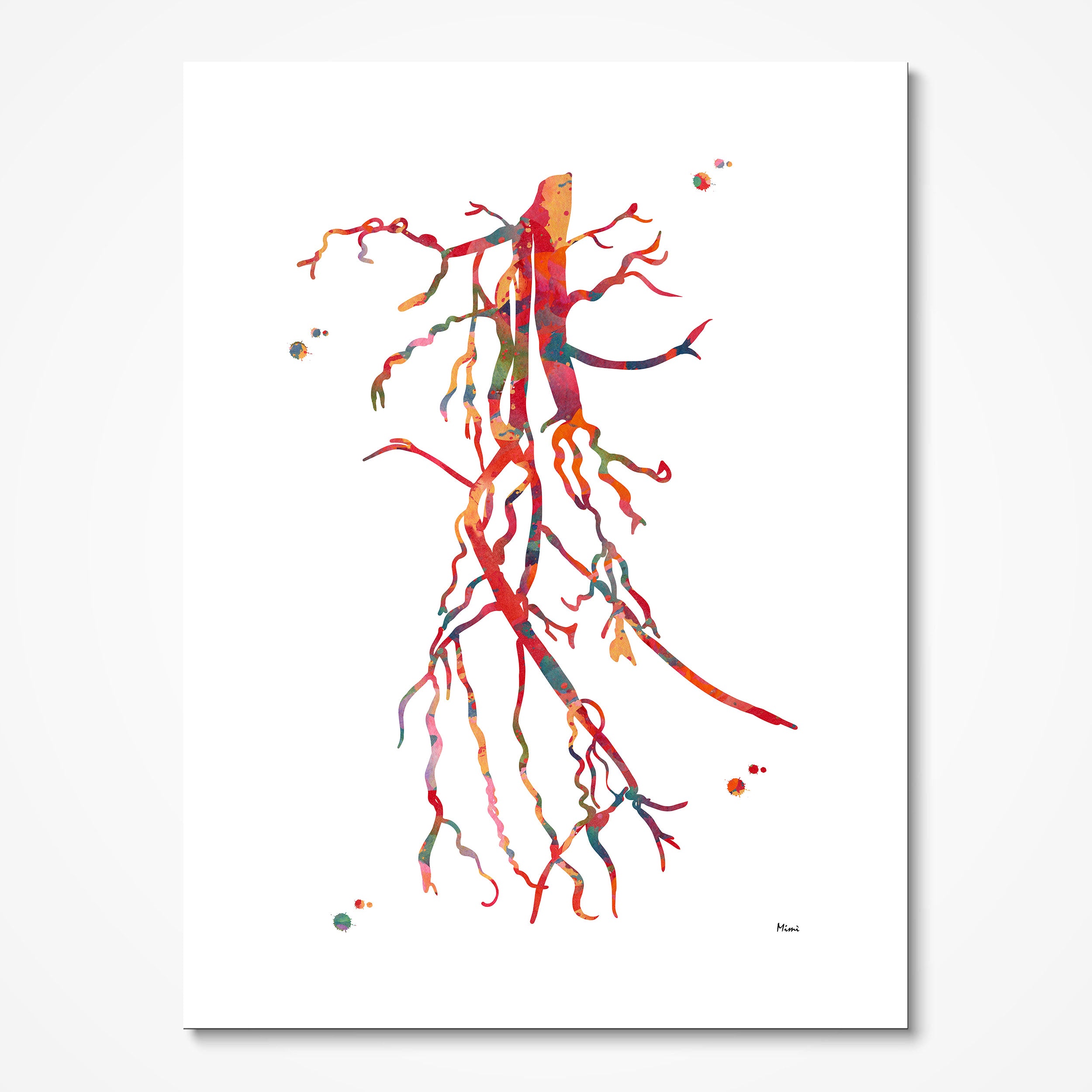 Femoral Spf Artery Occlusion Angiography Print