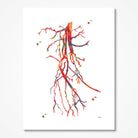 Femoral Spf Artery Occlusion Angiography Print