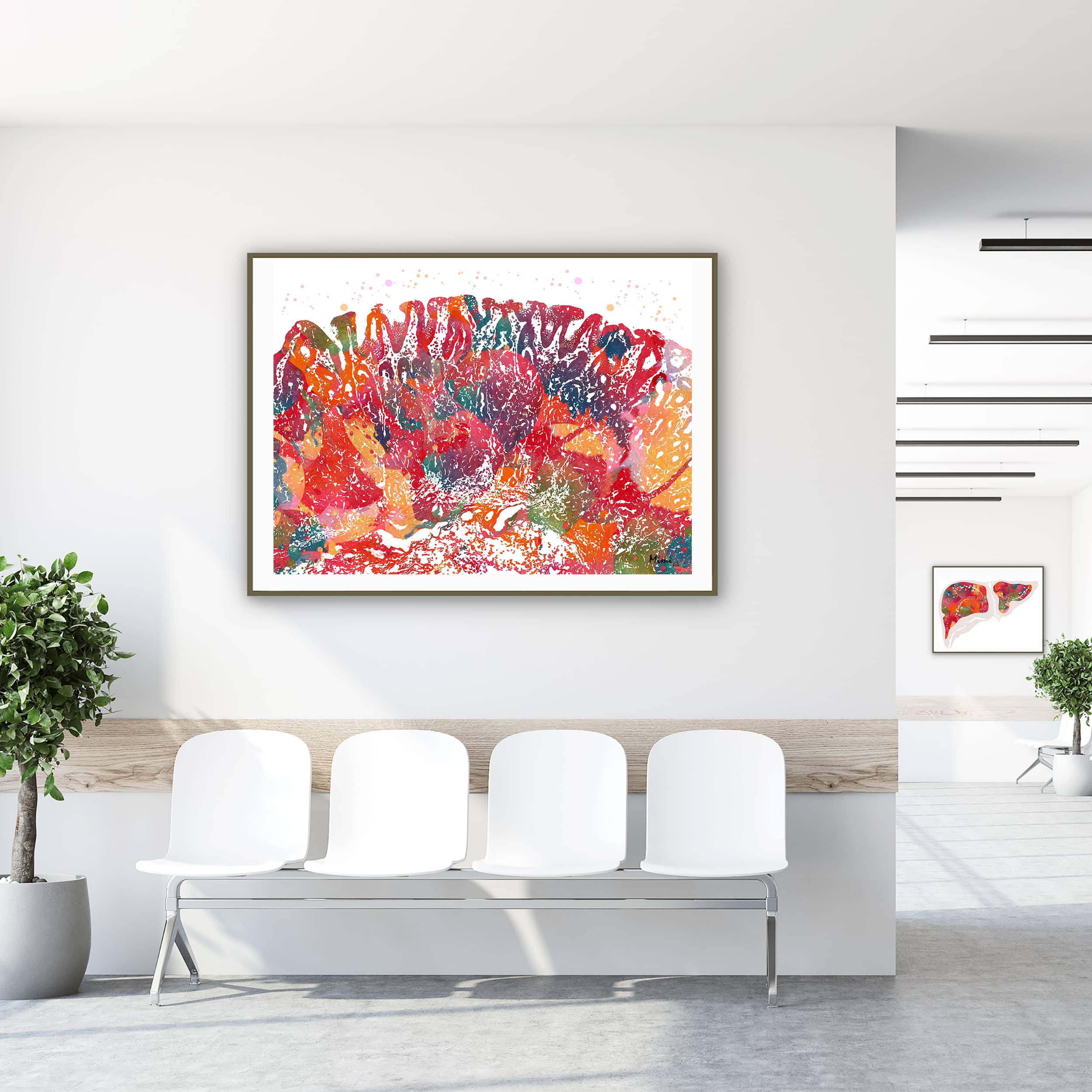 Framed gastric mucosa watercolor print in a clinic waiting room