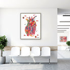Framed coronary artery bypass CABG watercolor print in a clinic waiting room