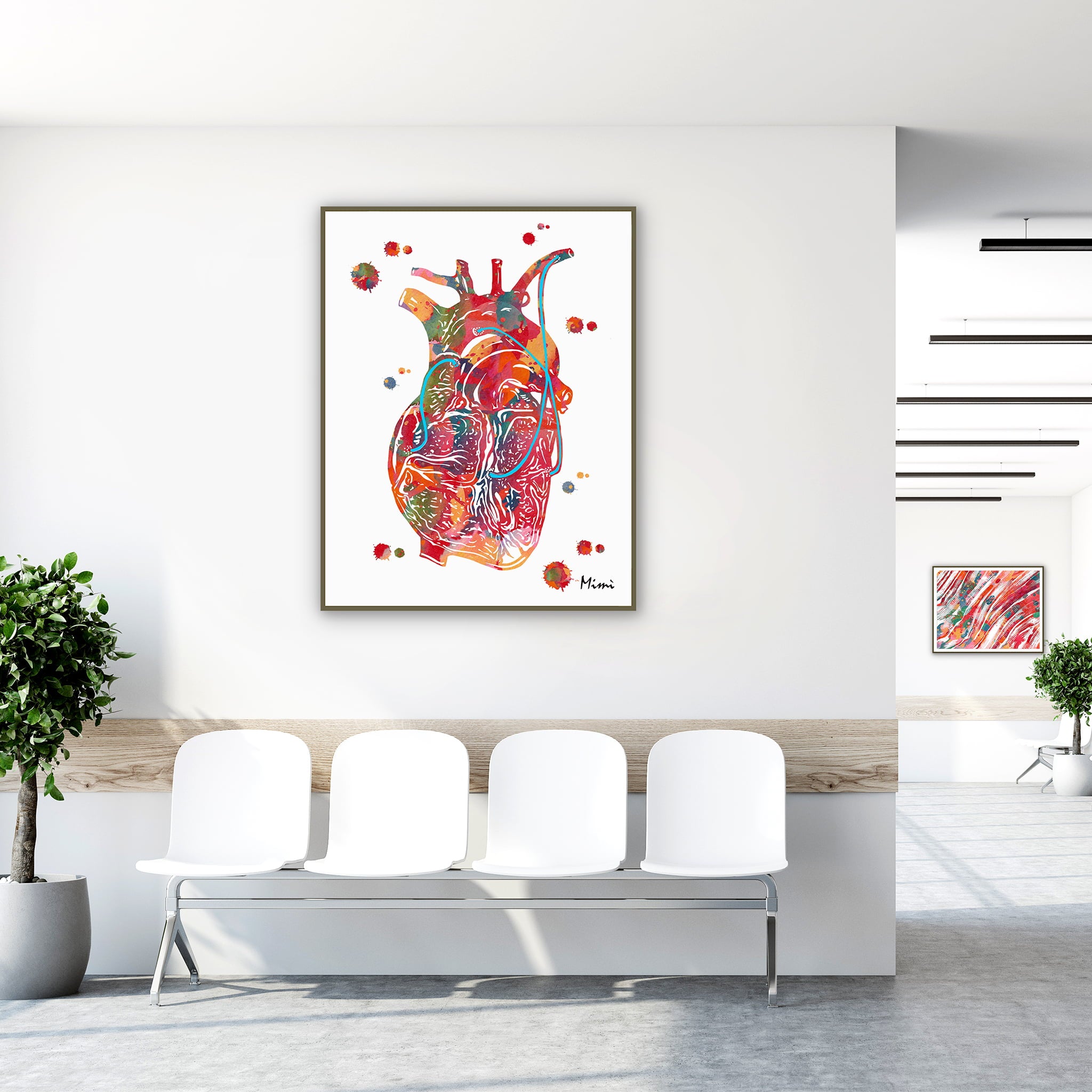 Framed coronary artery bypass CABG watercolor print in a clinic waiting room