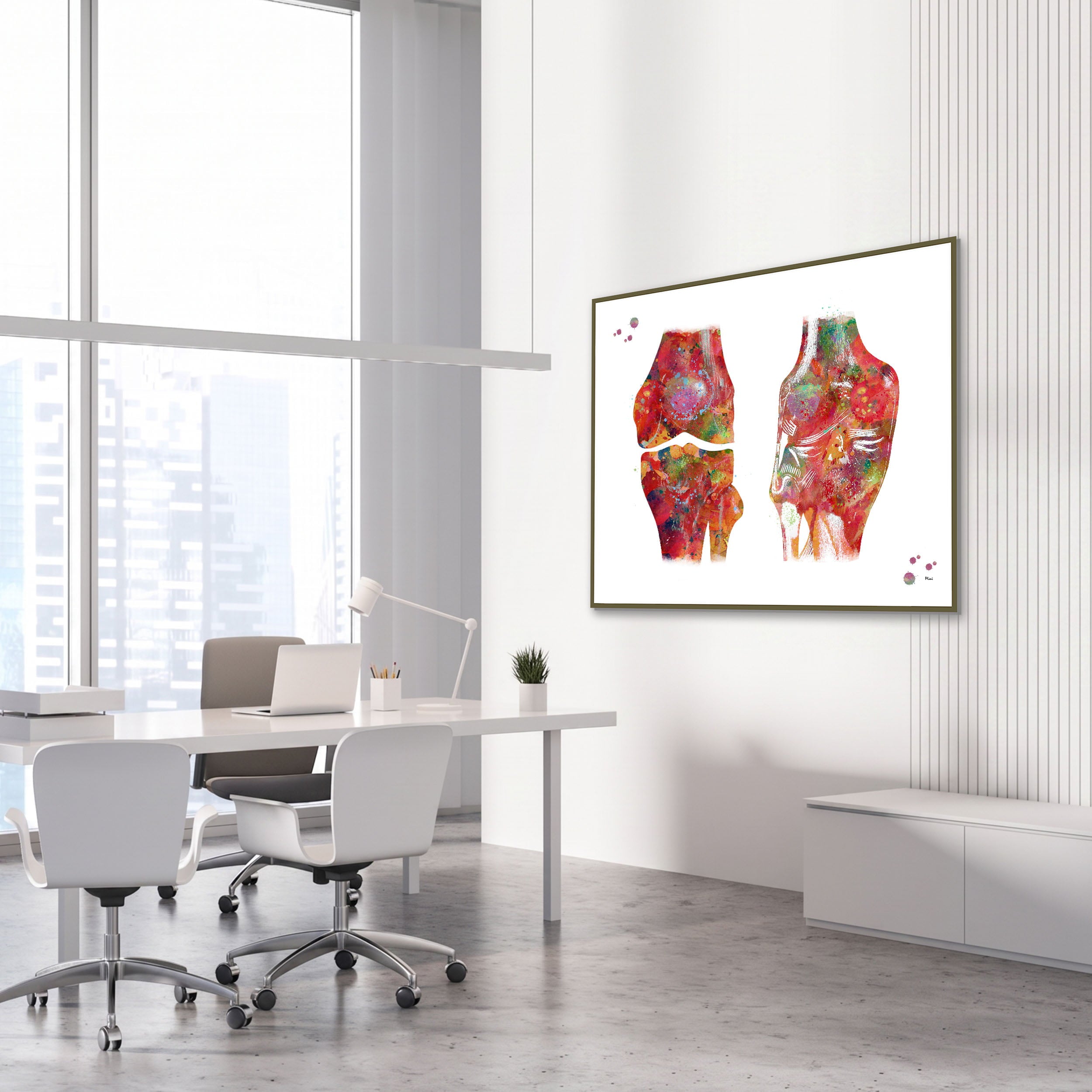 Framed human knee anatomy watercolor print in an orthopedic clinic