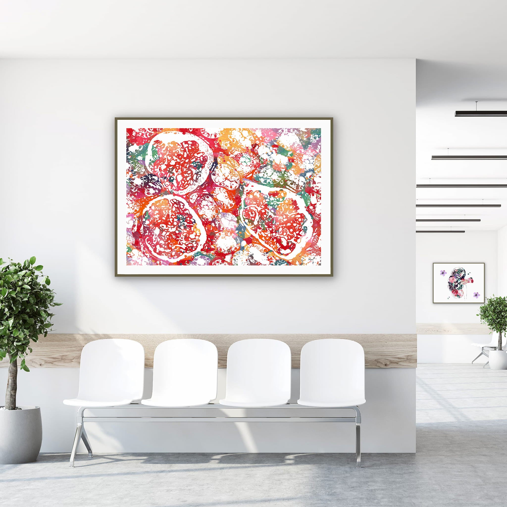 Framed kidney tissue histology watercolor print in a clinic waiting room