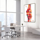 Framed knee bone anatomy watercolor print in an orthopedic clinic