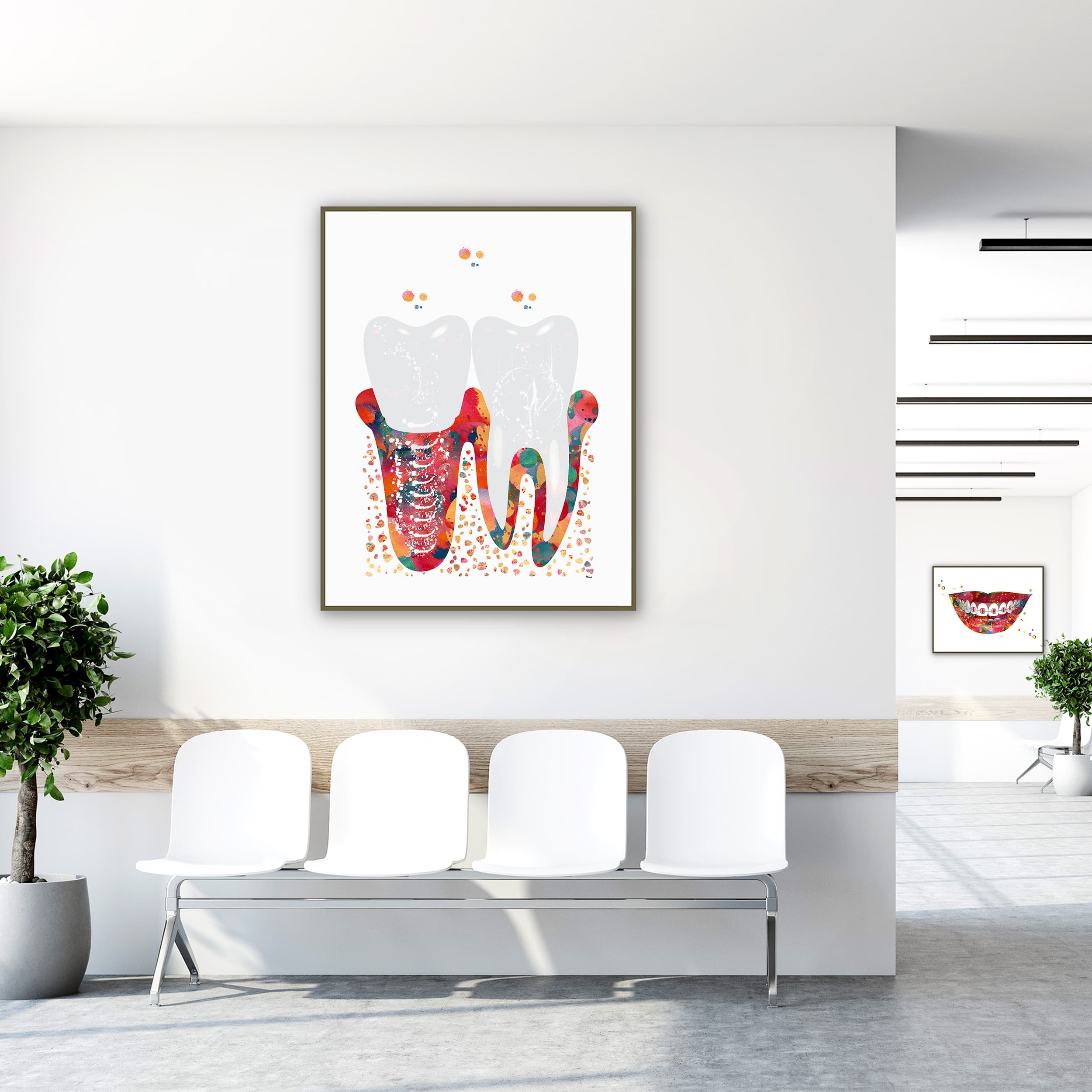 Framed molar implant watercolor print in a clinic waiting room