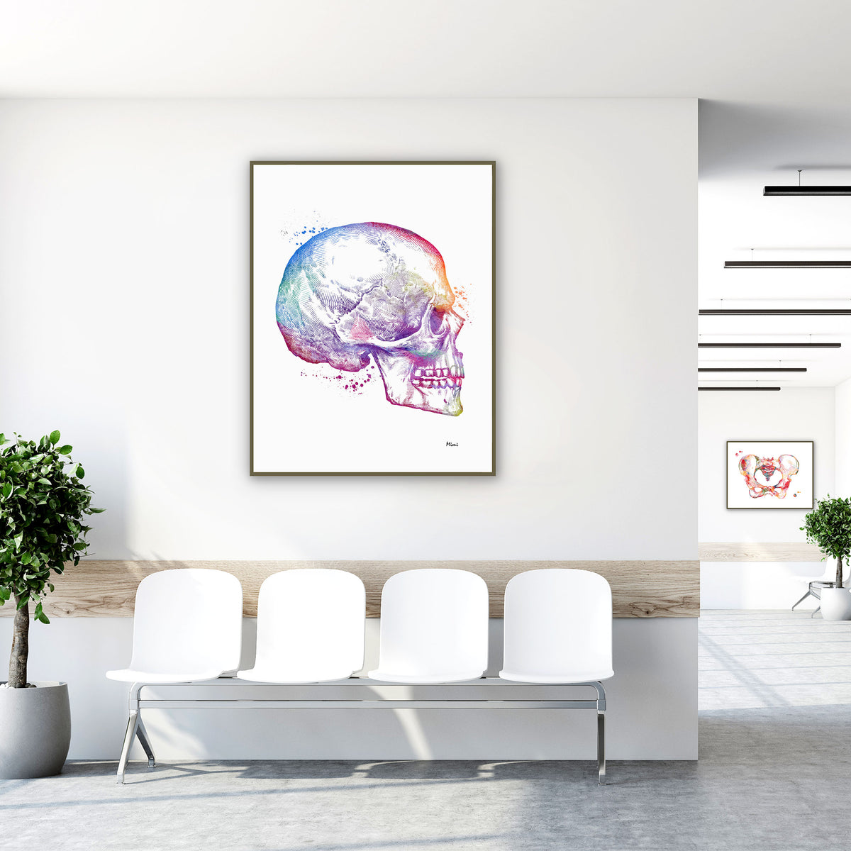 orthognathic surgery watercolor print hanging in a dental office