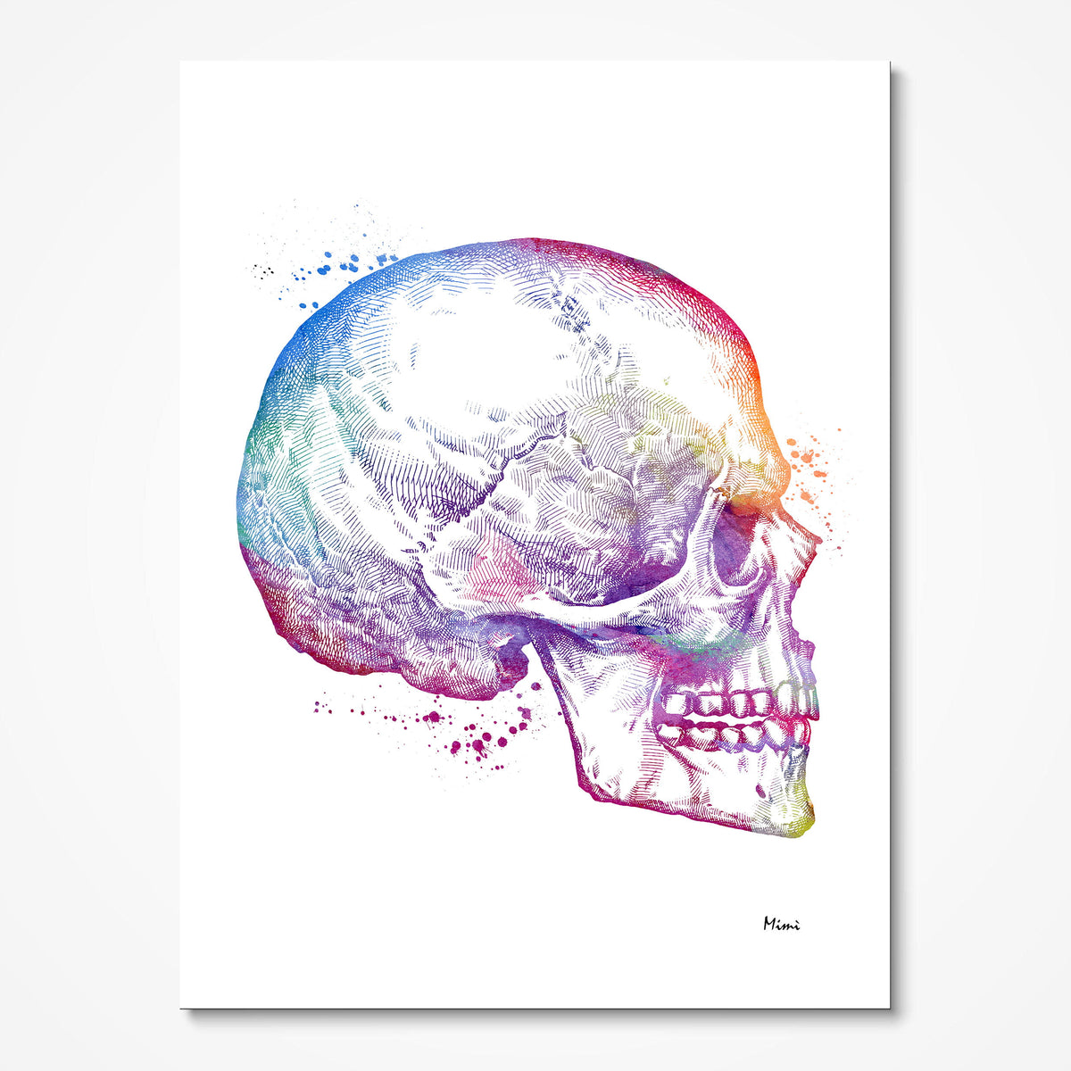 Orthognathic Surgery watercolor art print for Maxillofacial Office wall decor