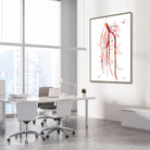 Framed popliteal artery angiogram watercolor print in a vascular clinic
