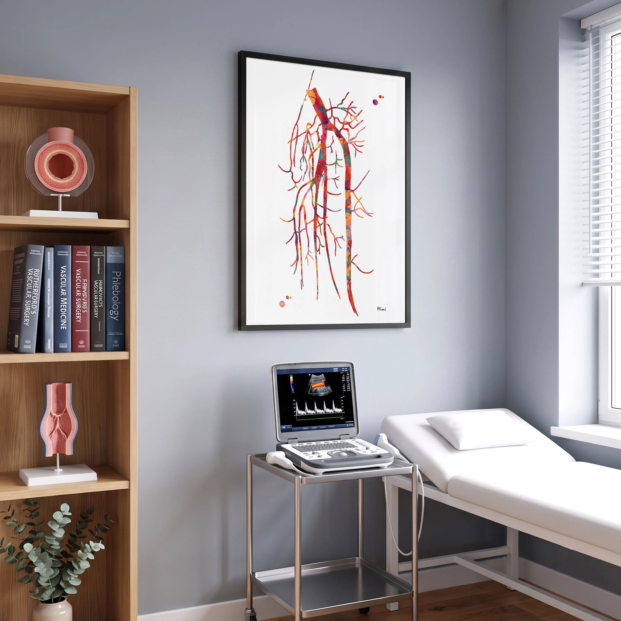Popliteal artery angiogram watercolor art print for vascular clinic wall decor