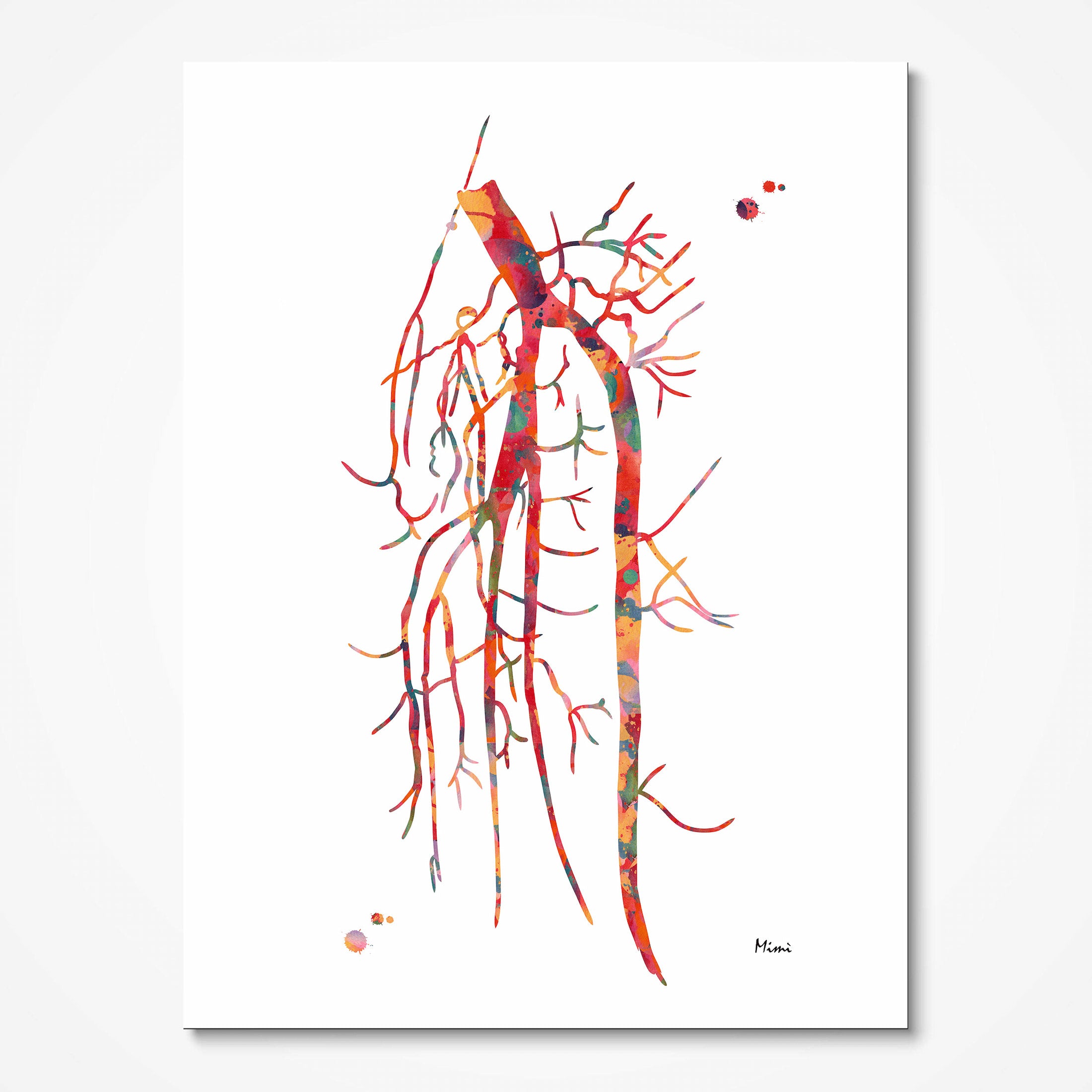 Popliteal artery angiogram watercolor art print for vascular clinic wall decor
