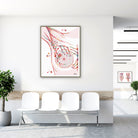 Framed sentinel lymph node watercolor print in a clinic waiting room