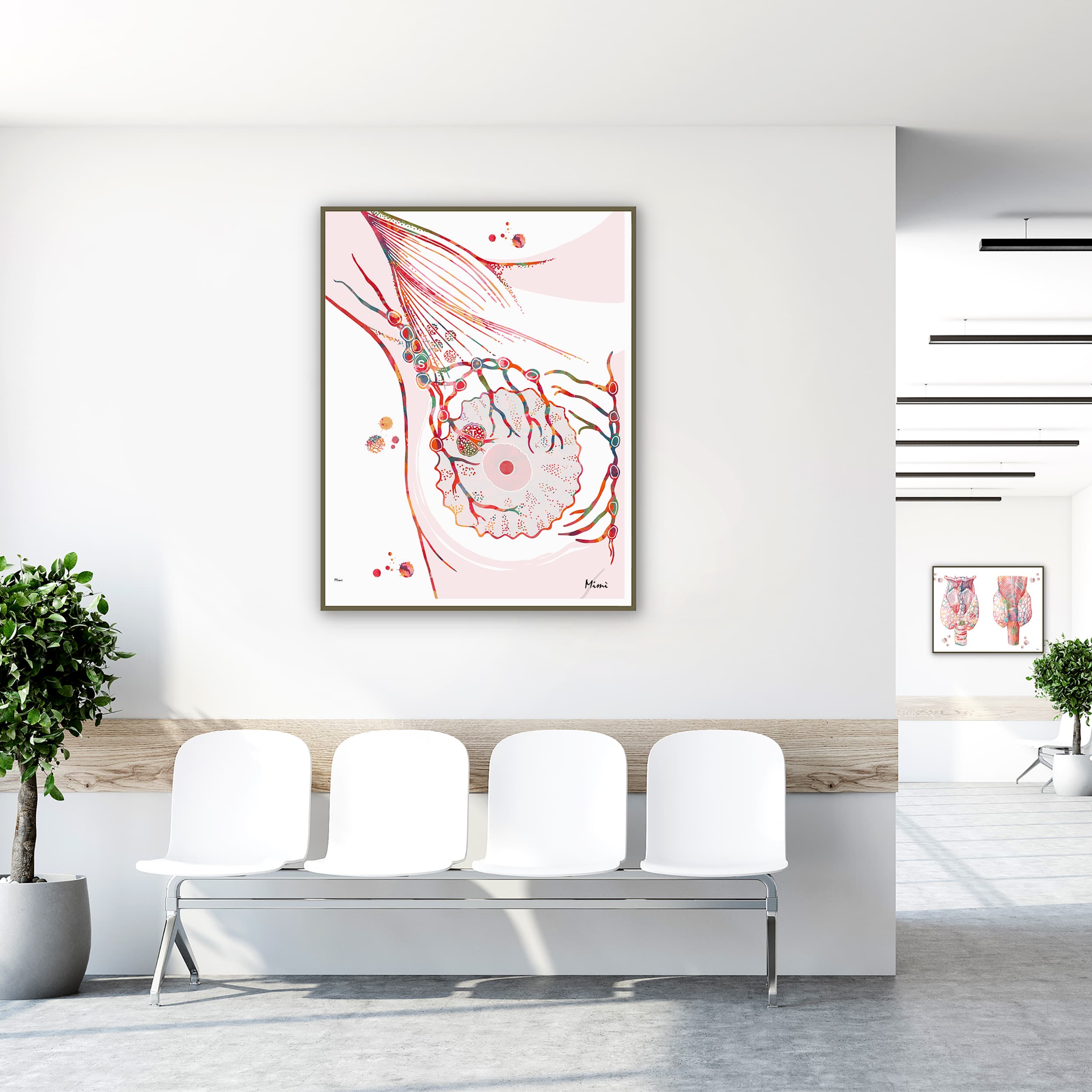 Framed sentinel lymph node watercolor print in a clinic waiting room
