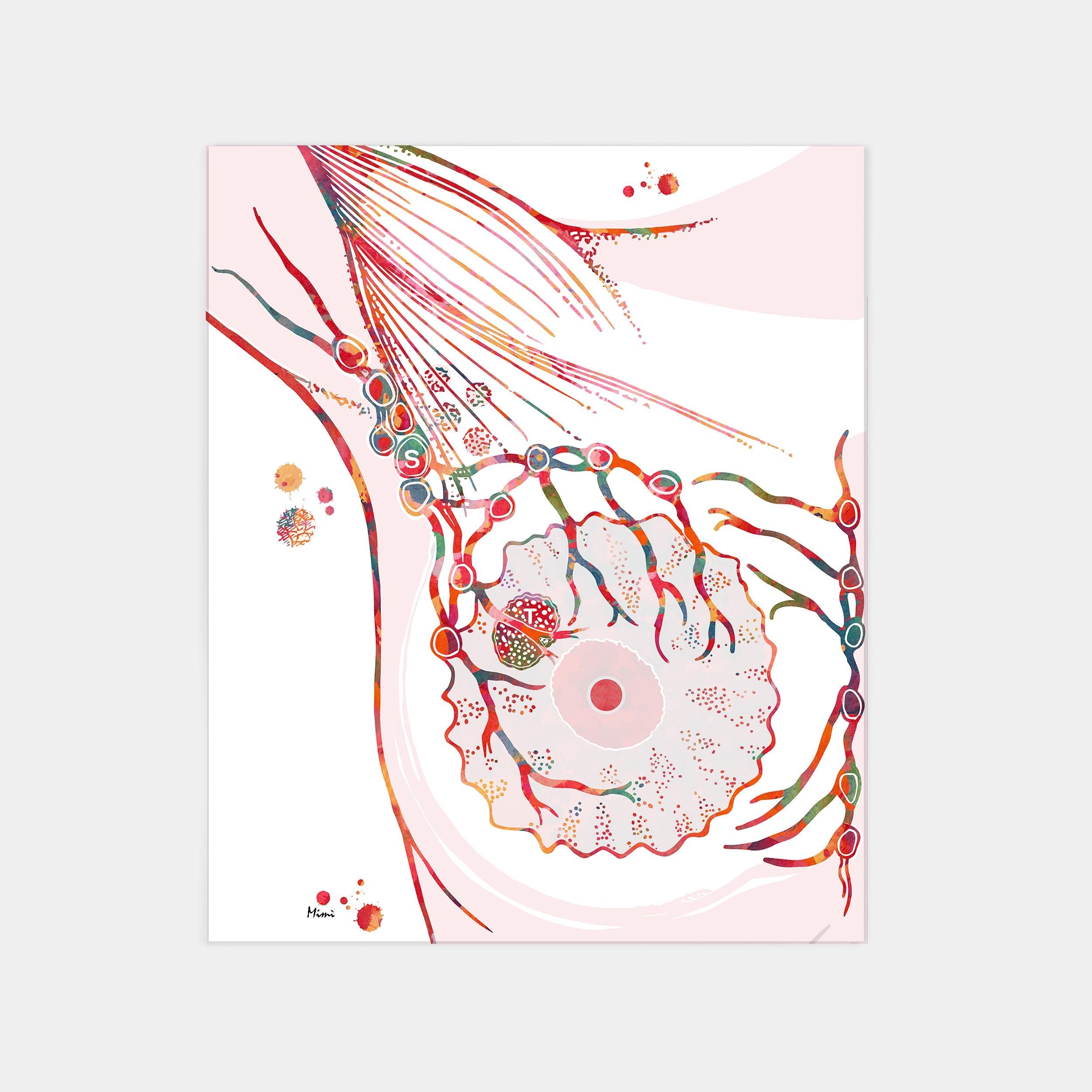 Sentinel Lymph Node watercolor art print for oncology clinic wall decor