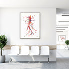 Framed superficial femoral artery (SFA) occlusion angiogram watercolor print in a clinic waiting room