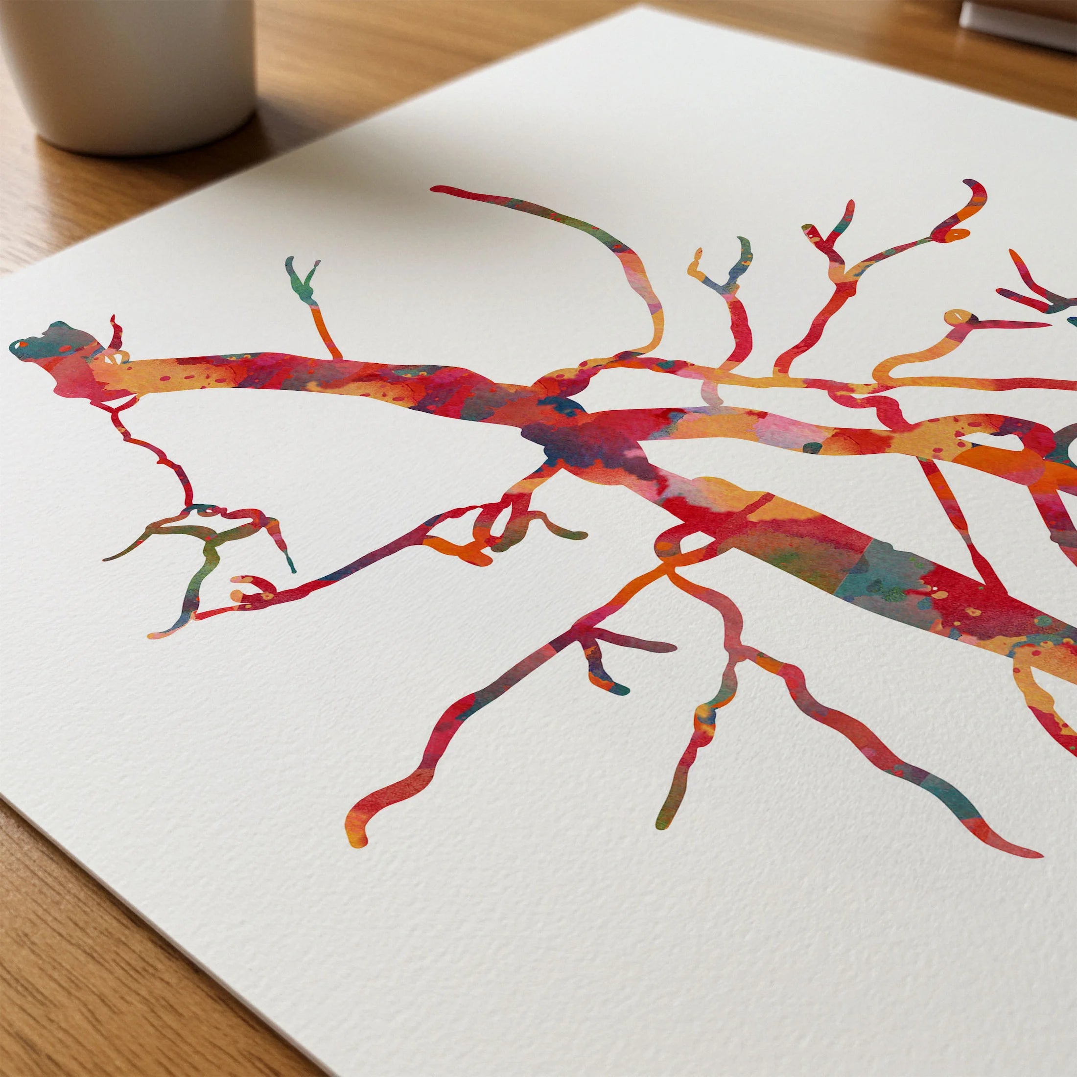 Close-up of superficial femoral artery (SFA) occlusion angiogram watercolor print showing paper texture and grain
