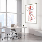 Framed superficial femoral artery (SFA) occlusion angiogram watercolor print in a vascular clinic