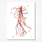 Superficial femoral artery (SFA) occlusion angiogram watercolor art print for vascular clinic wall decor