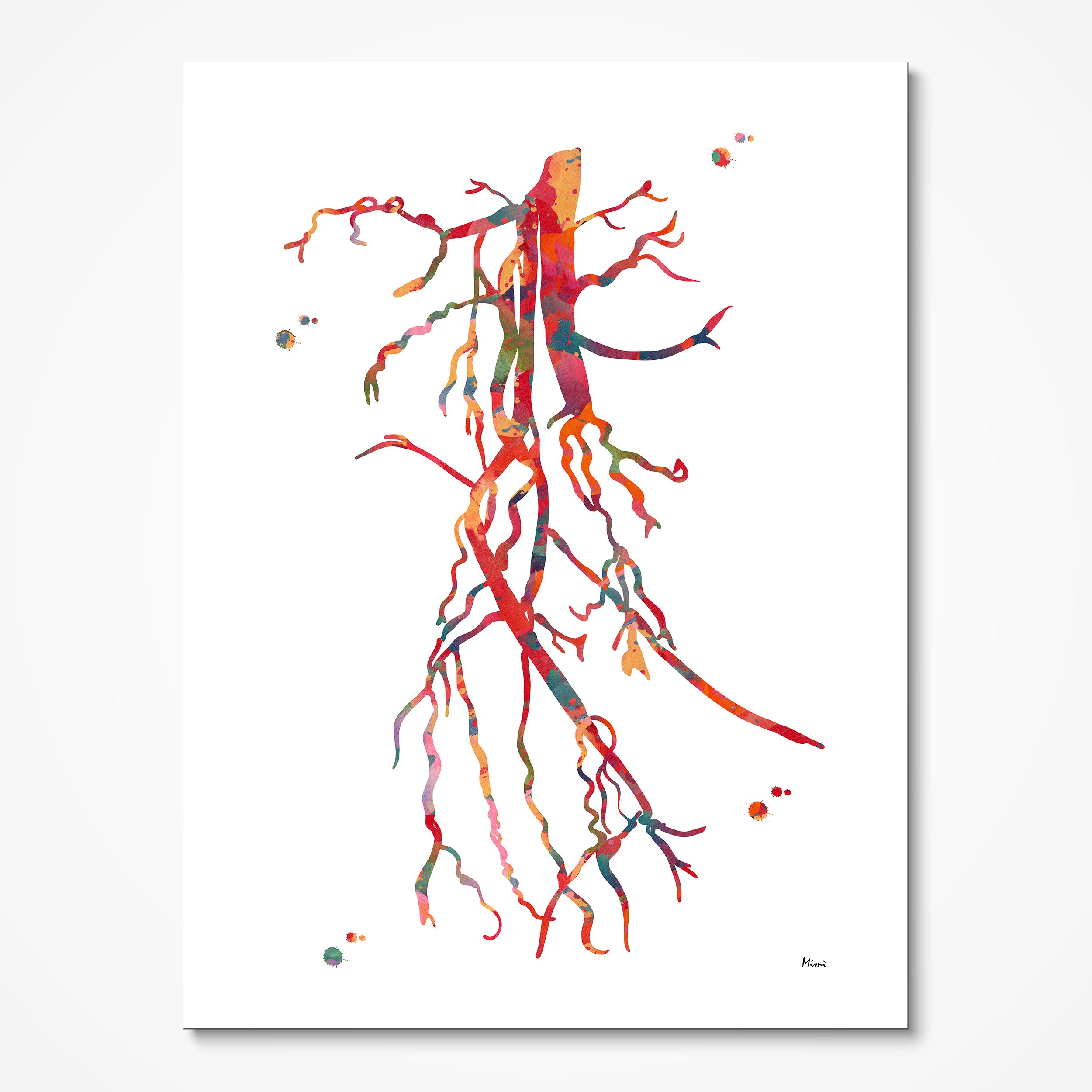 Superficial femoral artery (SFA) occlusion angiogram watercolor art print for vascular clinic wall decor