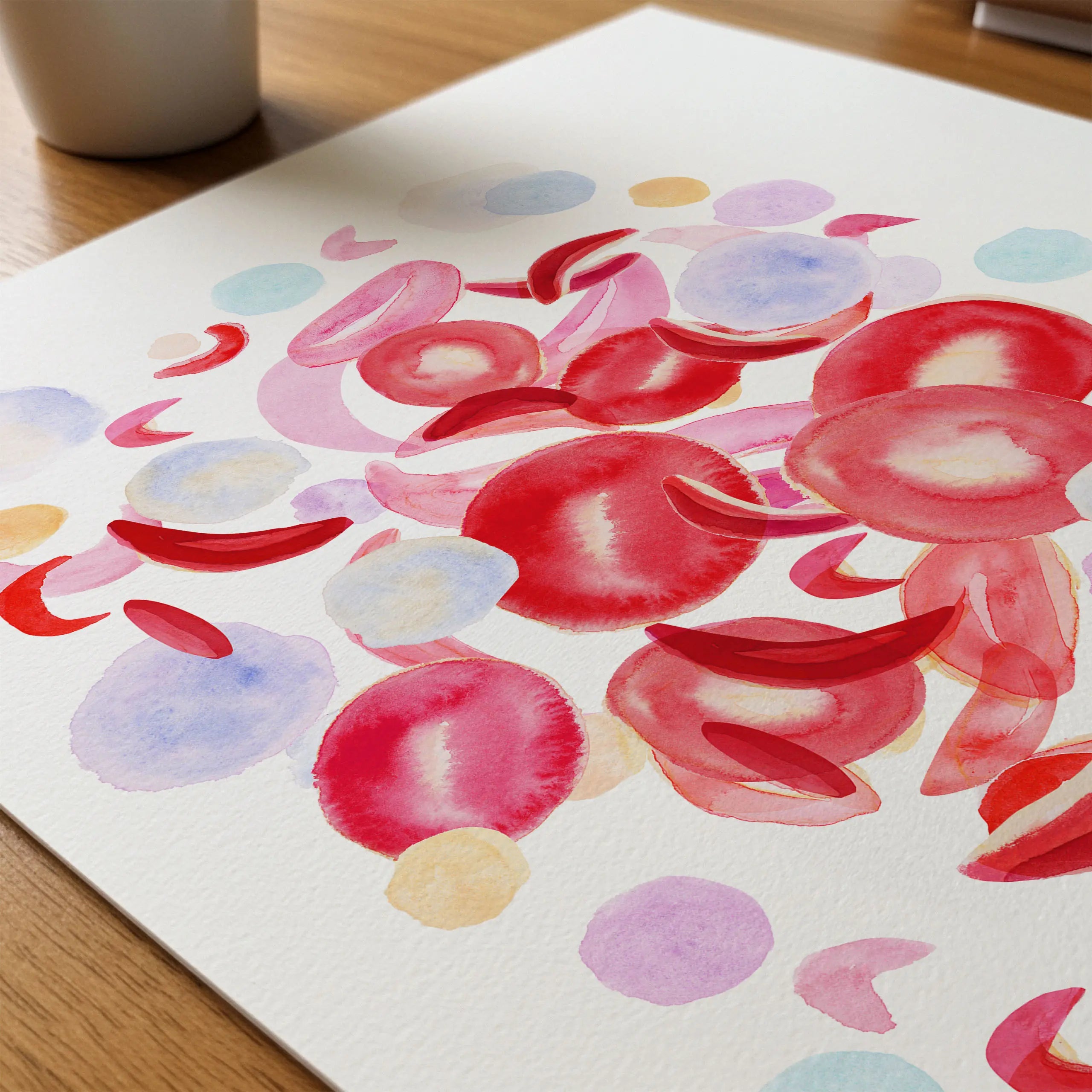 Close-up of sickle cell anemia watercolor print showing paper texture and grain