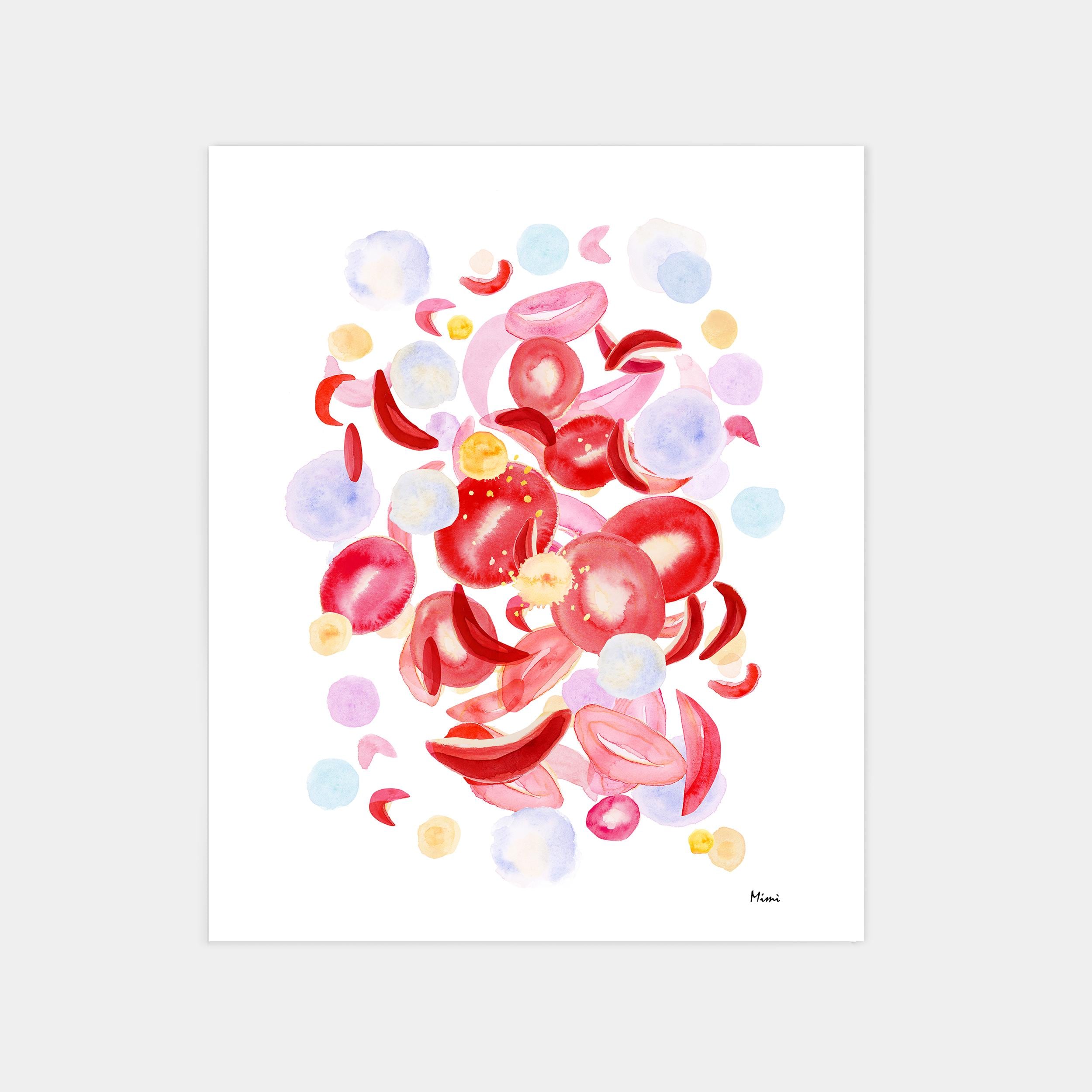 Sickle Cell Anemia watercolor art print for hematology lab wall decor