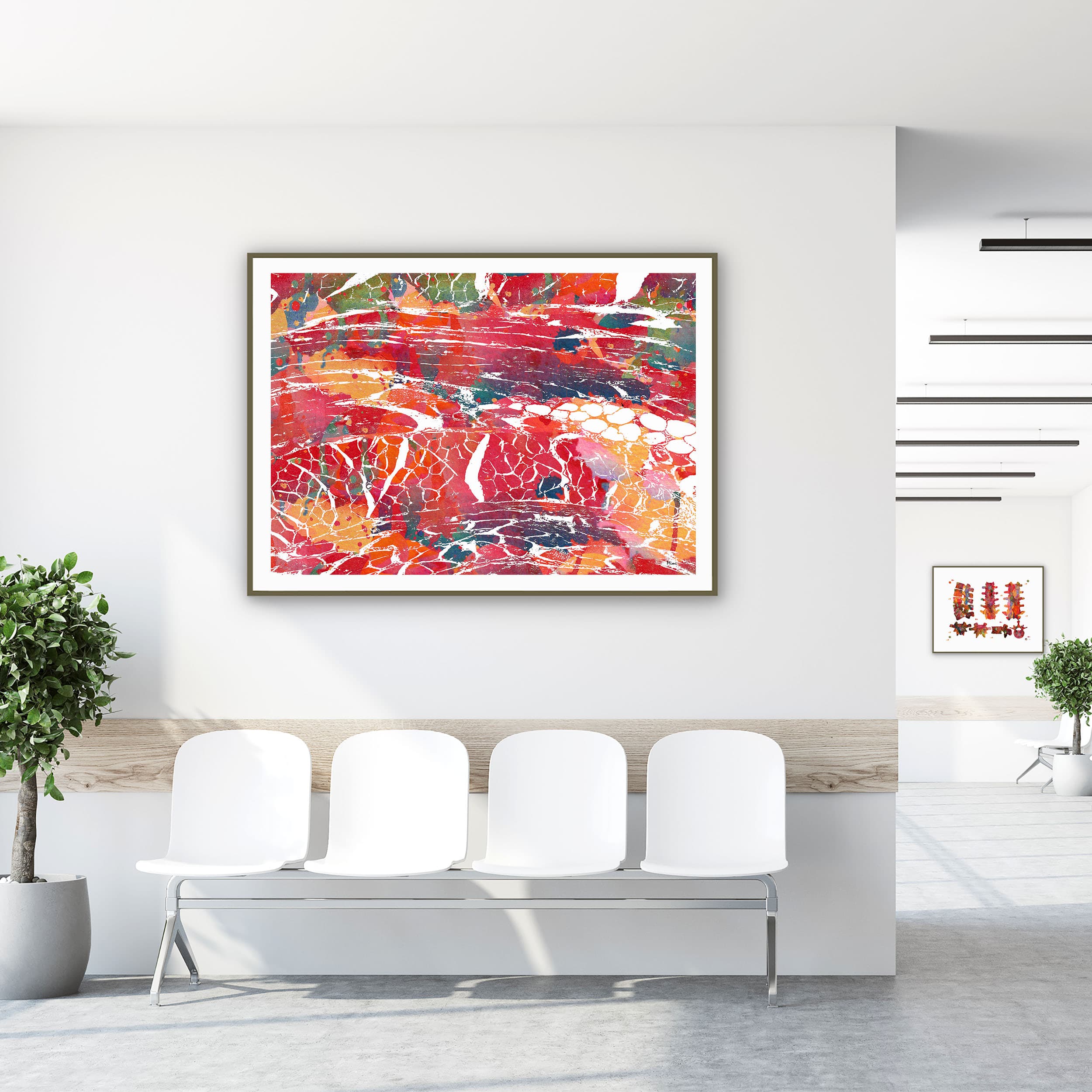Framed skeletal muscle histology watercolor print in a clinic waiting room