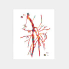 SPF femoral artery occlusion angiogram watercolor art print for vascular clinic wall decor