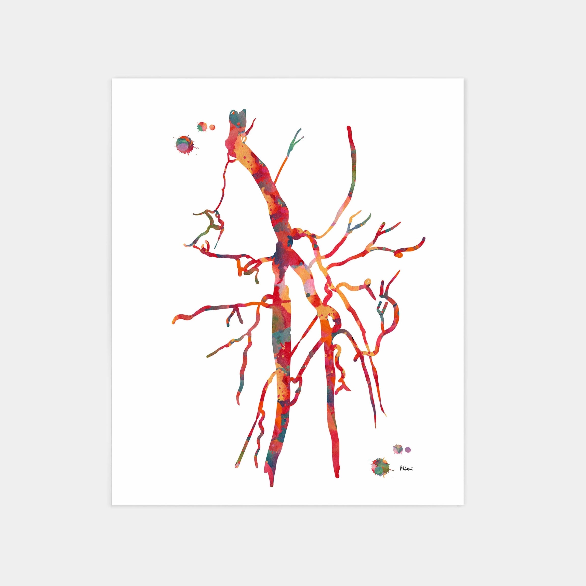 SPF femoral artery occlusion angiogram watercolor art print for vascular clinic wall decor