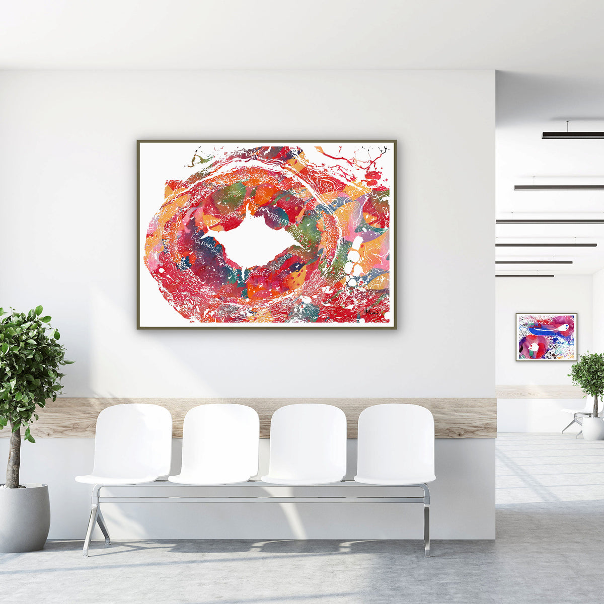 Framed temporal artery histology watercolor print in a clinic waiting room