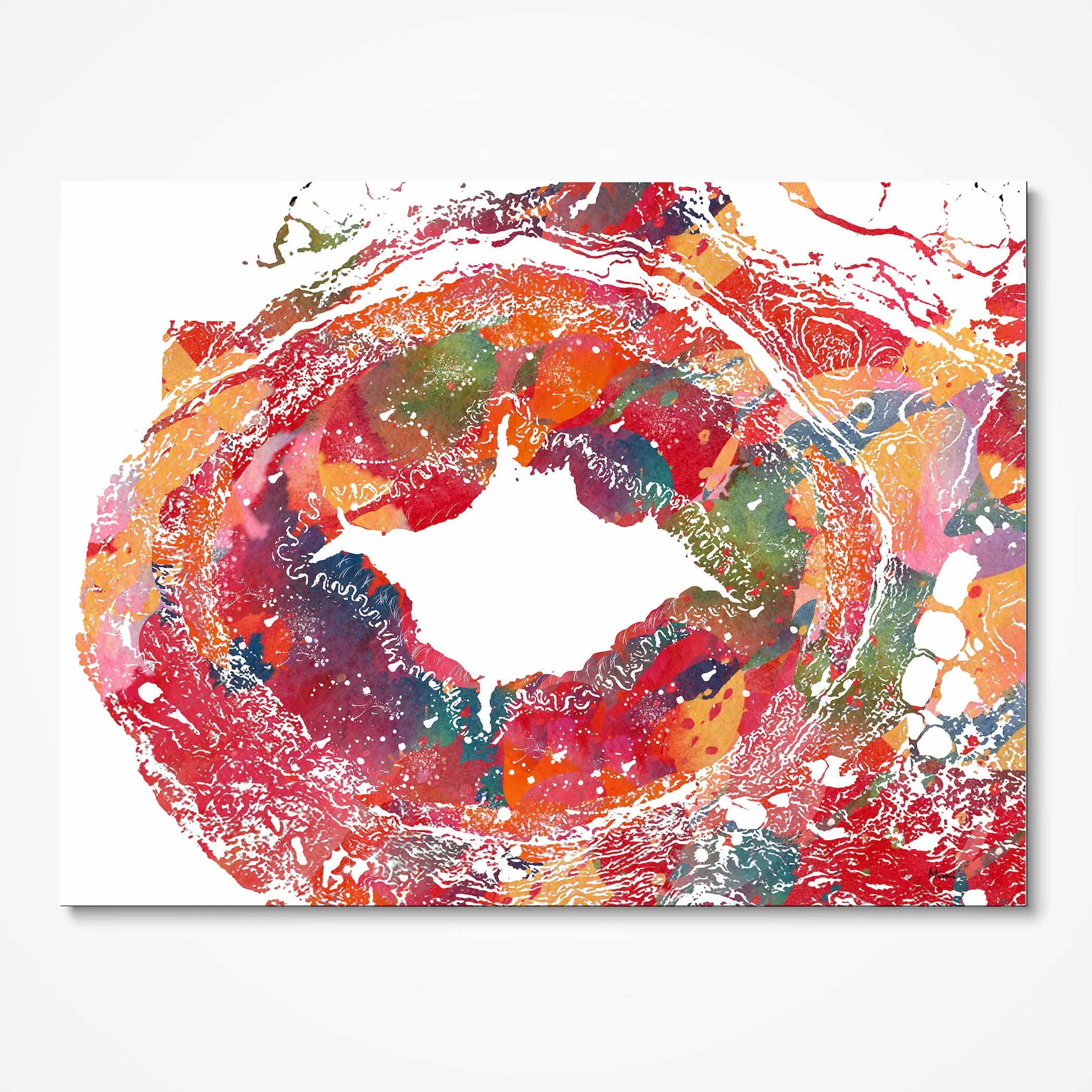 Temporal artery histology watercolor art print for angiology clinic wall decor