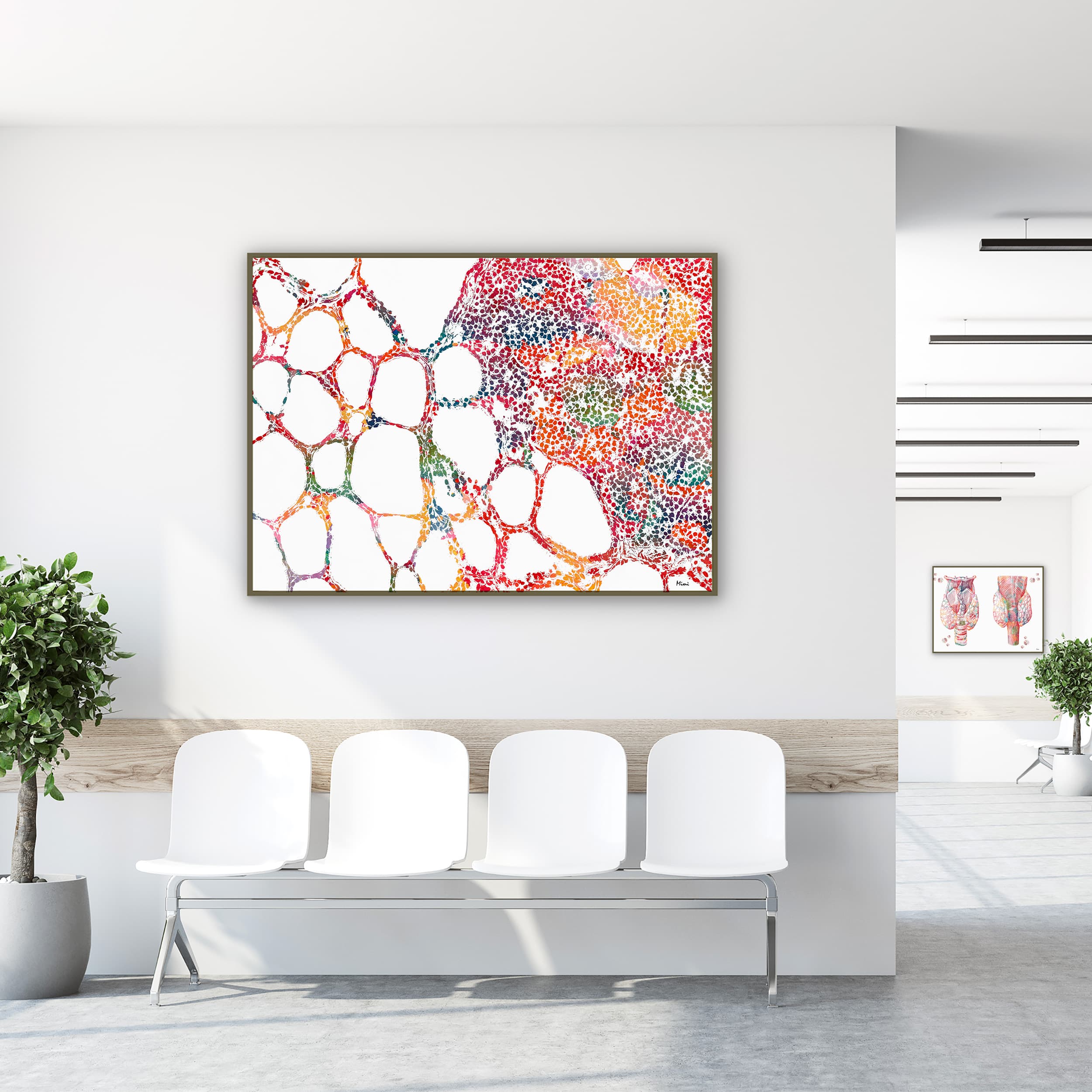 Framed thyroid histology watercolor print in a clinic waiting room