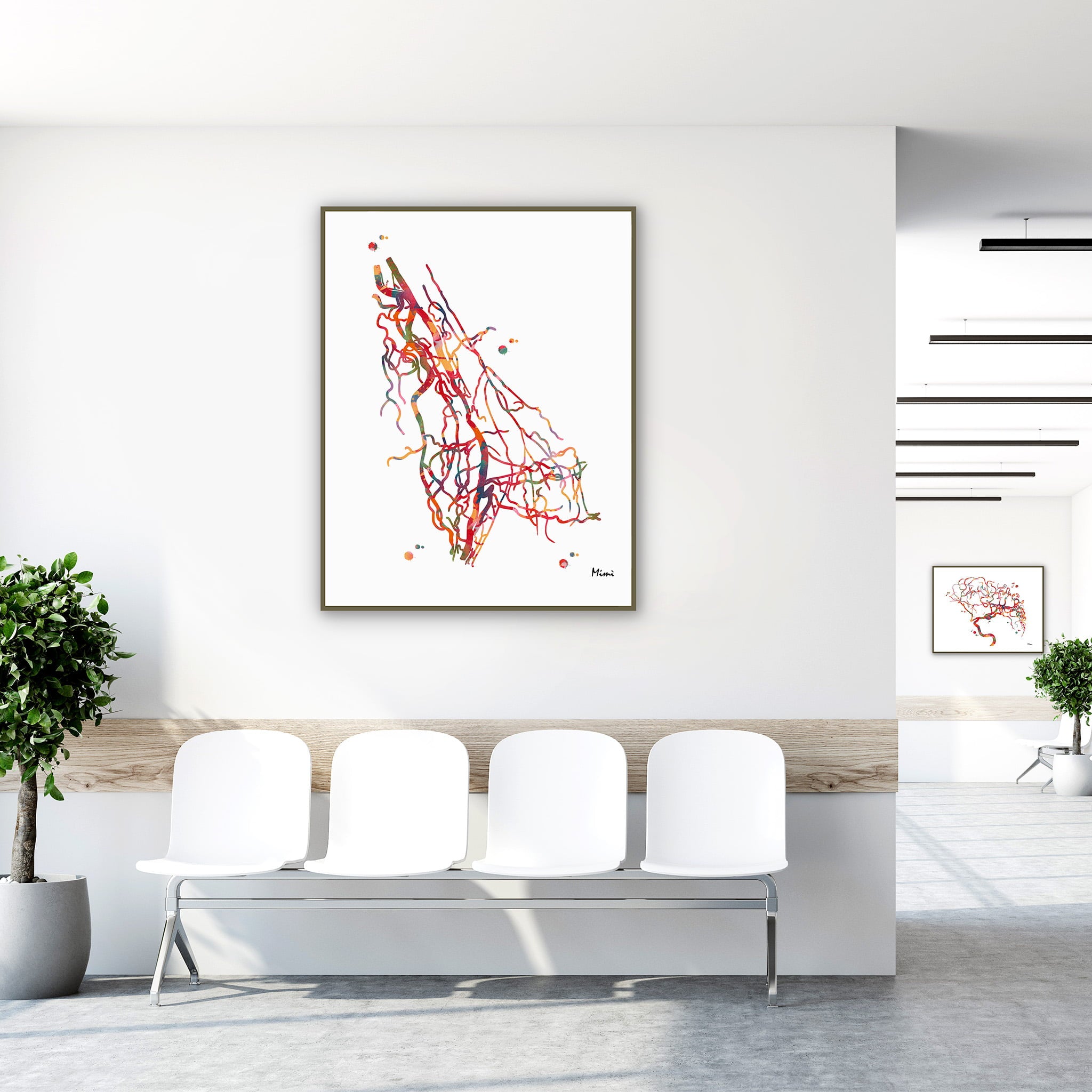 Framed upper limb arteries DSA angiogram watercolor print in a clinic waiting room