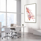Framed upper limb arteries DSA angiogram watercolor print in a vascular clinic