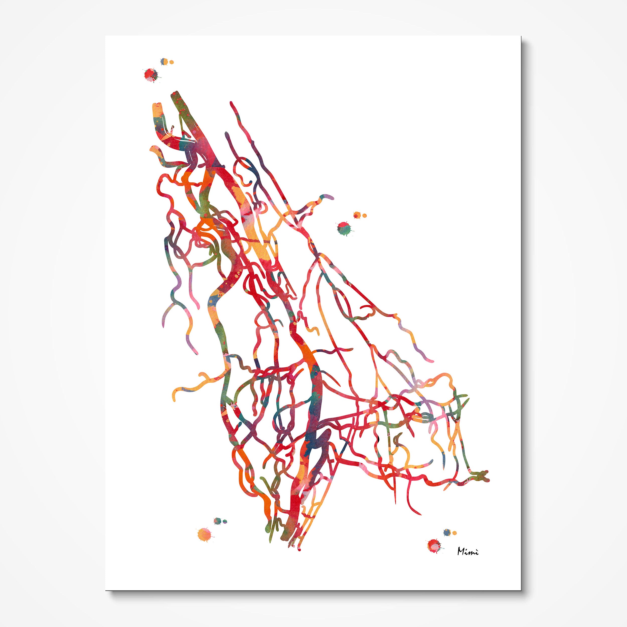 Upper limb arteries DSA angiogram watercolor art print for vascular clinic wall decor