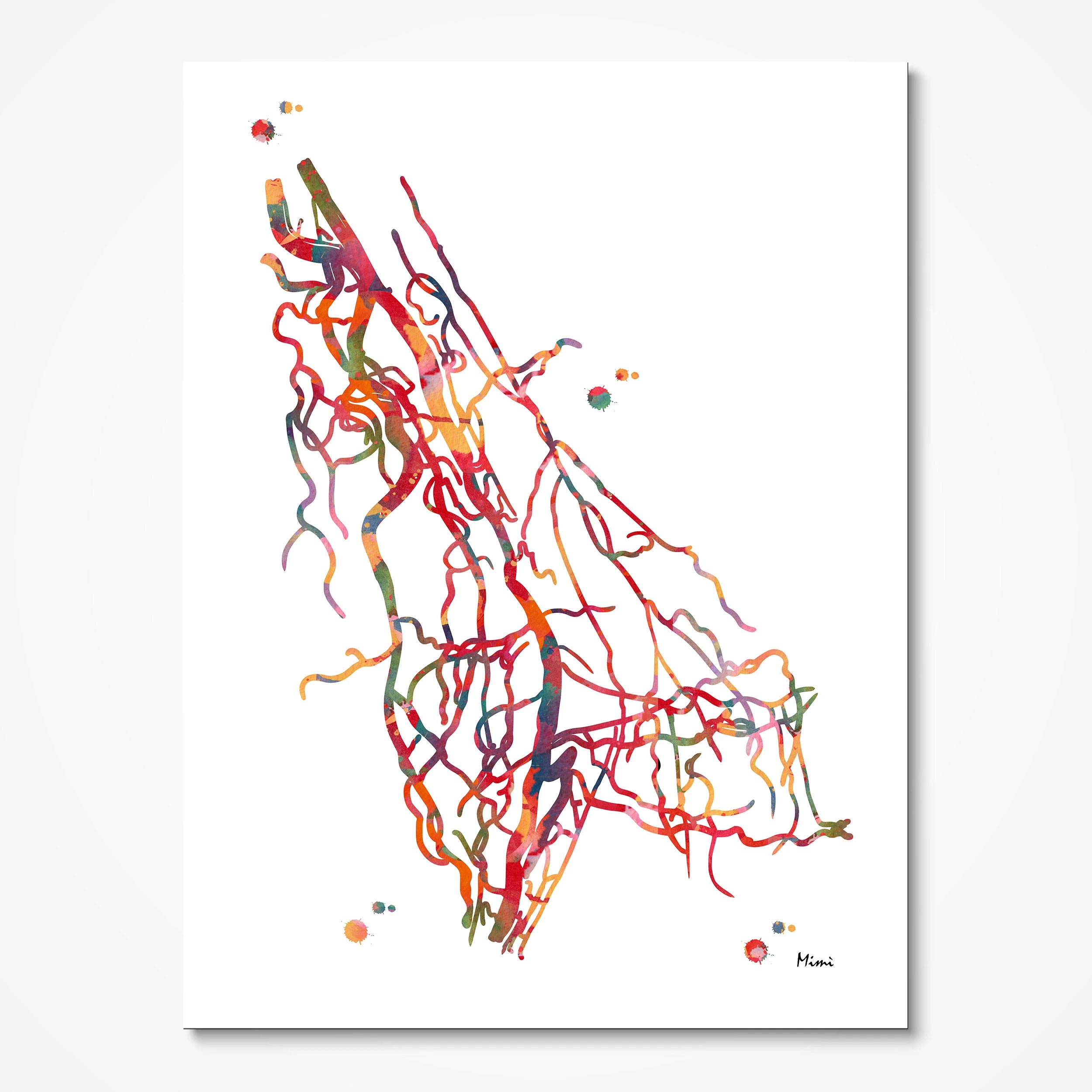 Upper limb arteries DSA angiogram watercolor art print for vascular clinic wall decor