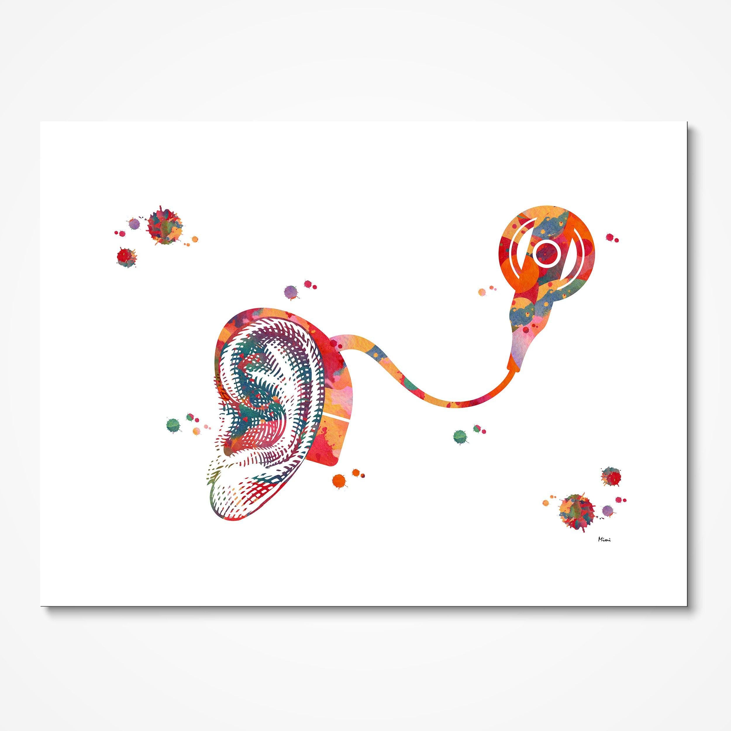 Cochlear Implant Anatomy Print Audiology Poster