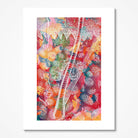 Epidermis Anatomy Print Human Skin Watercolor Illustration Integumentary System poster