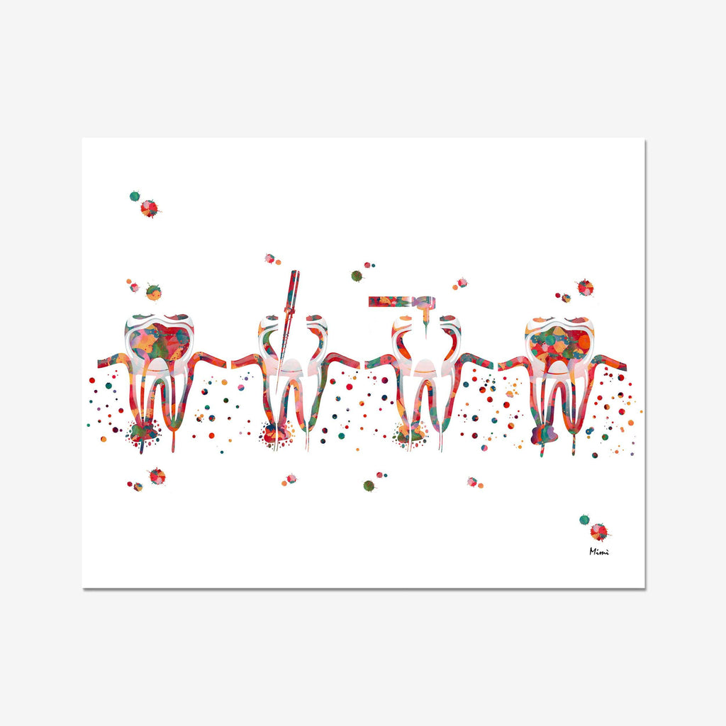 Root Canal Procedure Dental Art Print Endontic Therapy Illustration Stomatology Dentist Clinic Wall Art