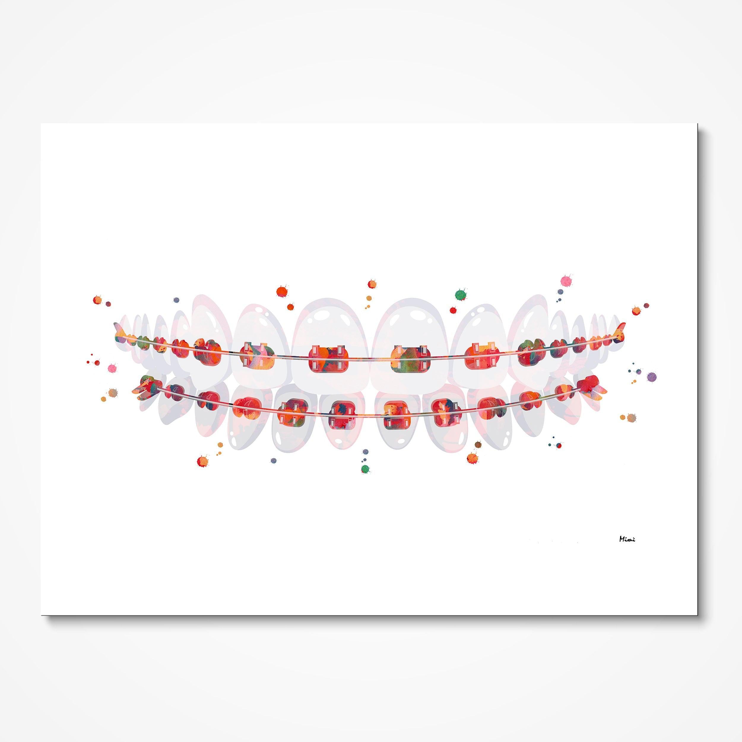 Teeth Braces Dental Art Print Teeth Brackets Dentist Clinic Wall Decor Abstract Anatomy Poster Orthodontics