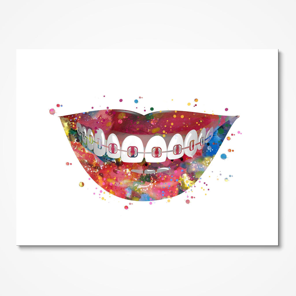 Teeth Braces Dental Art Watercolor Print Smiling Mouth