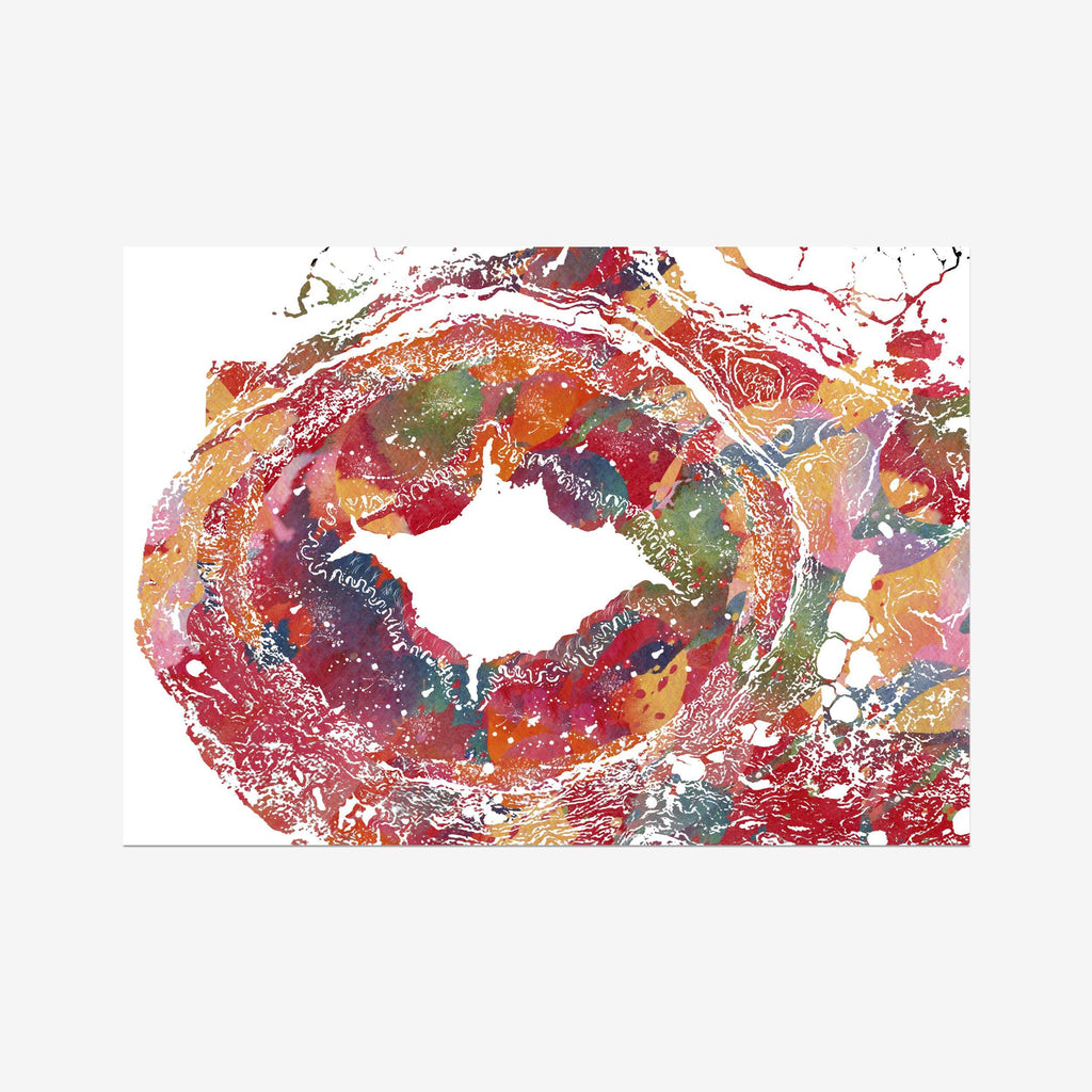 Temporal Artery Histology Watercolor Print
