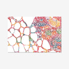 Thyroid Gland Anatomy Print Histology Watercolor Thyroid Medical Art Clinic Wall Decor