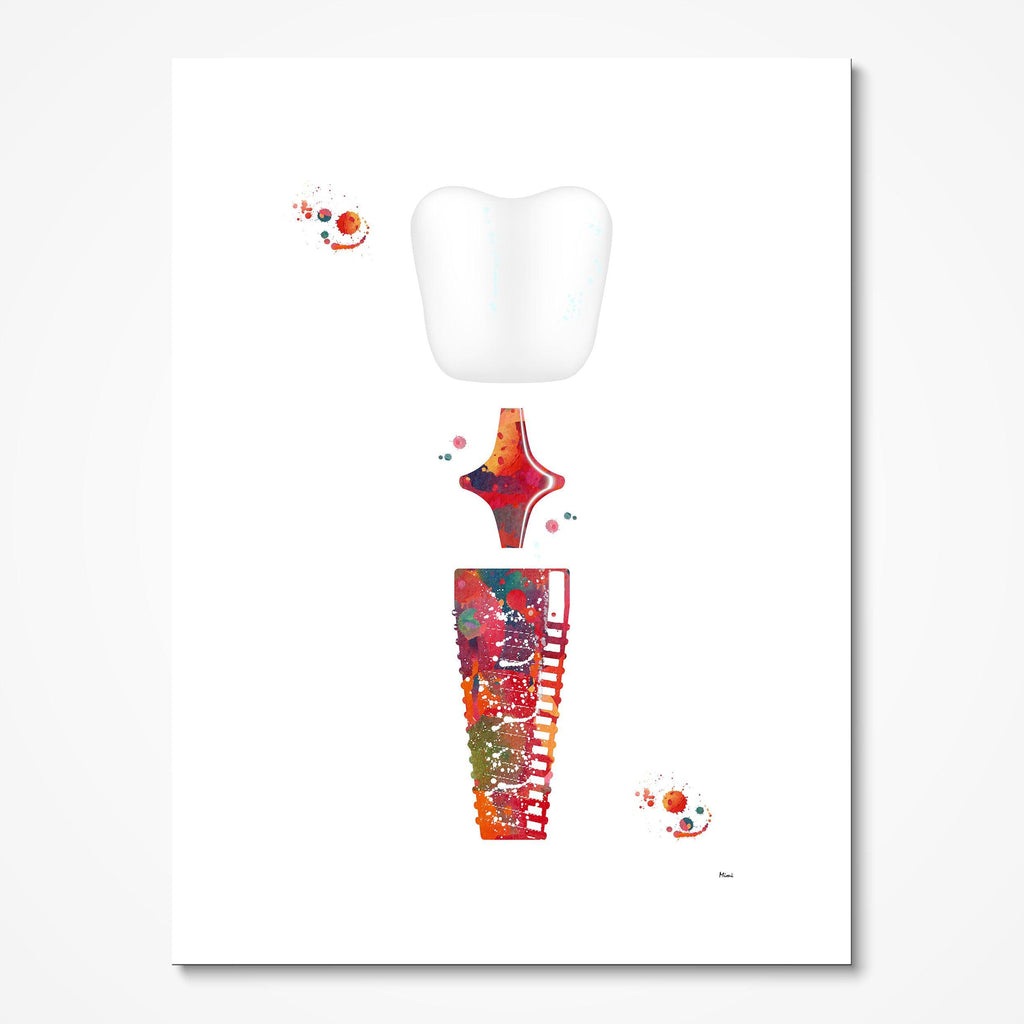 Tooth Dental Implant Anatomy Art Watercolor Print